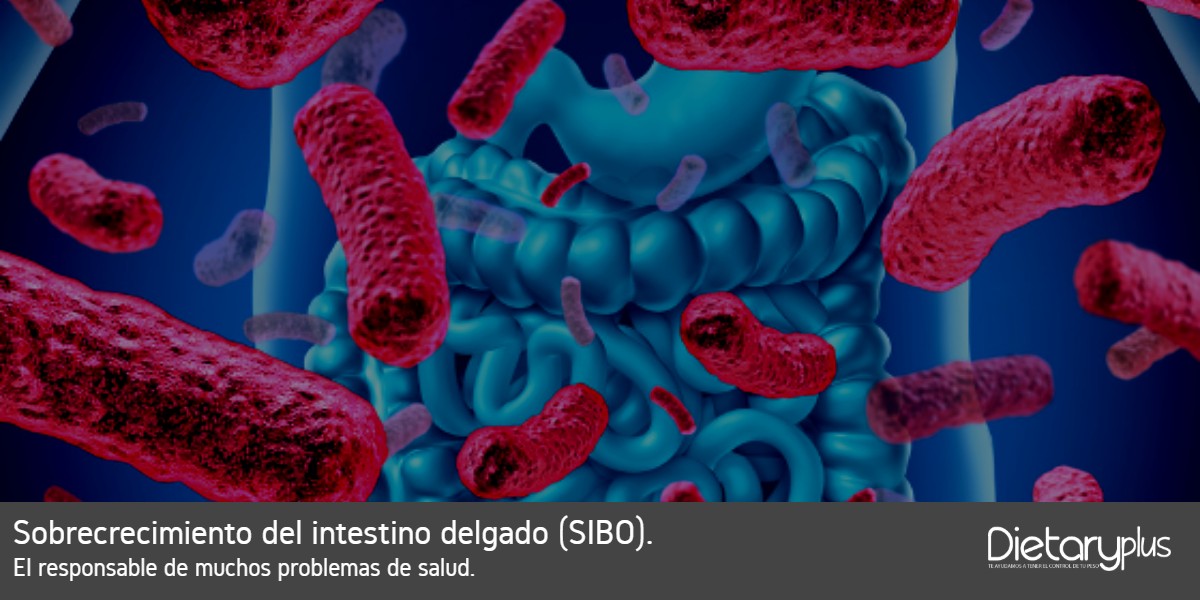 ( SIBO ) Sobrecrecimiento-del-intestino-delgado