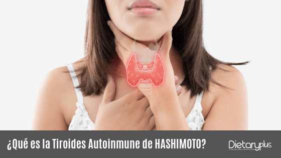 La tiroides autoinmune de Hashimoto